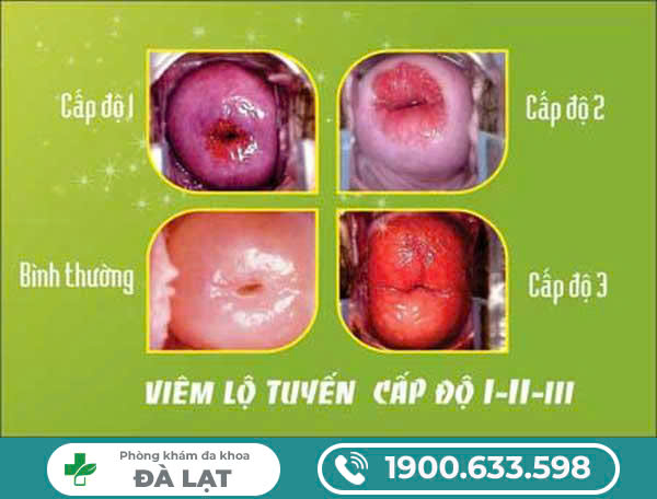 Block Image